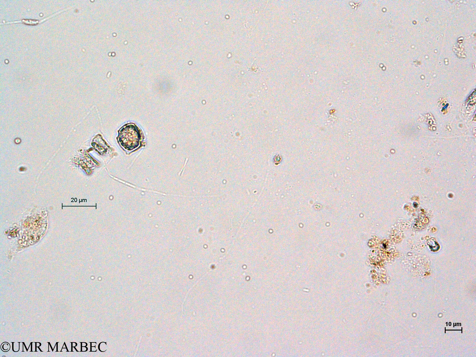 phyto/Thau_Lagoon/THAU_station1/GELAMED 2010/Scrippsiella trochoidea (2)(copy).jpg